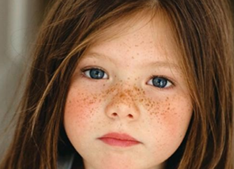 护肤分享:长斑原因?为什么你的皮肤粗糙暗沉,这些必须要注意了