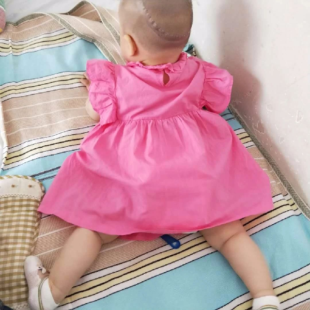 中性粒细胞减少症|出生就患病，1岁先天性重型中性粒细胞减少症患儿的打怪之旅