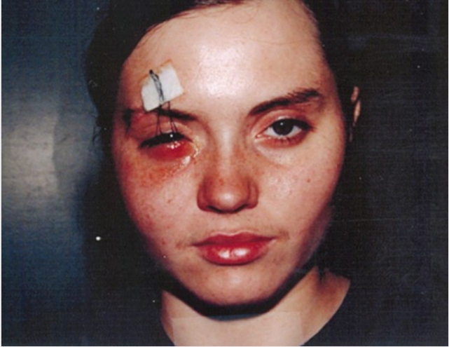 真实案件从酒店消失的她为何遍体鳞伤地出现在郊外