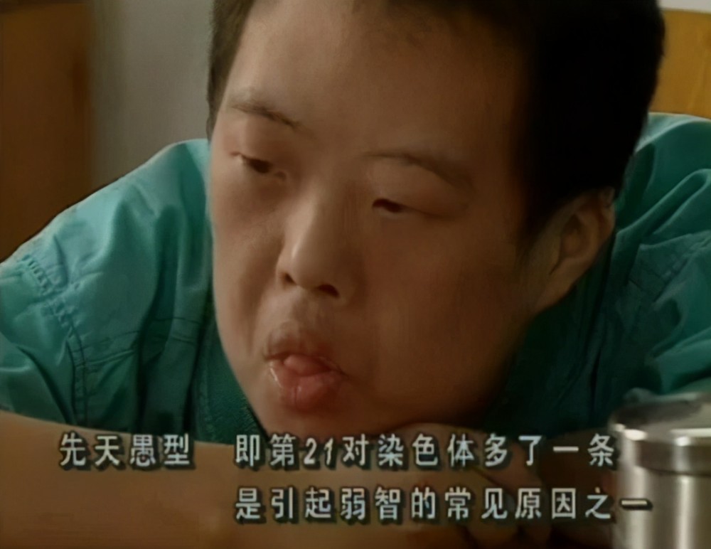 舟舟:天才指挥官却智商残缺,被捧红后跌下神坛,今落魄惹人怜_腾讯新闻