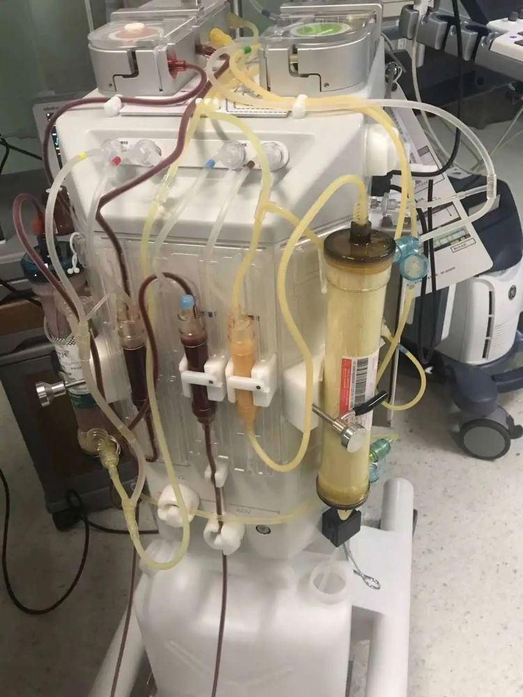 9月13日中午,方先生吃了一只红烧猪蹄后不久就出现腹痛,腹胀,恶心呕吐