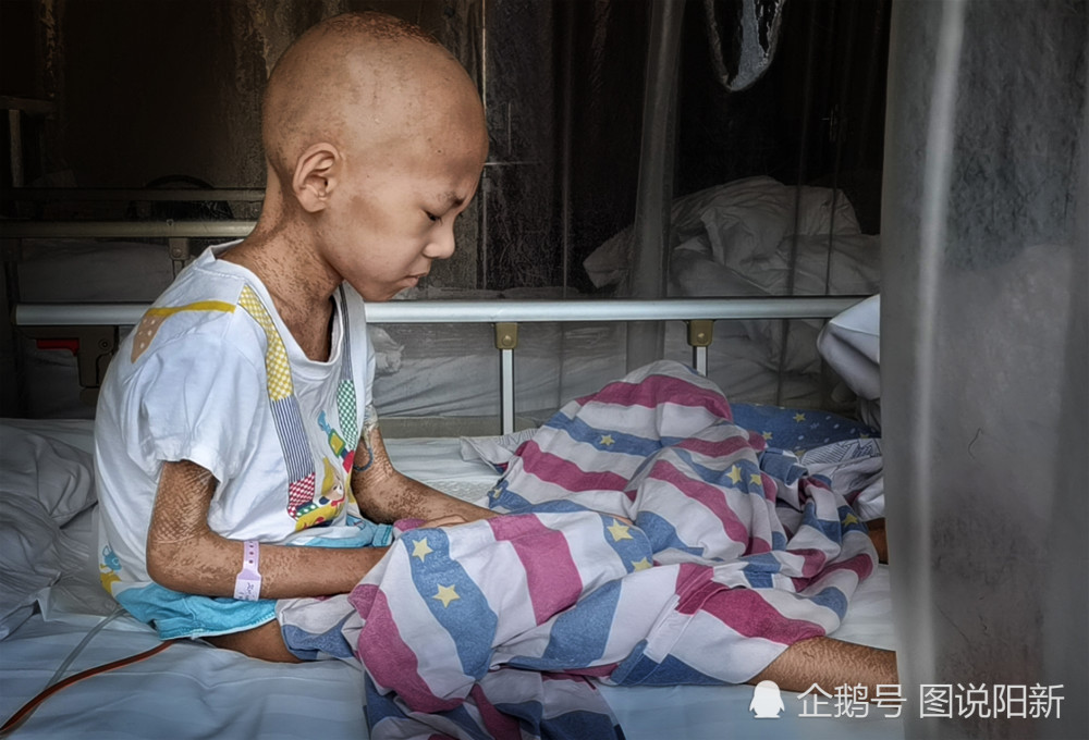 7岁江西男孩千里北上求医百毒侵袭皮包骨最大心愿回家陪奶奶过中秋