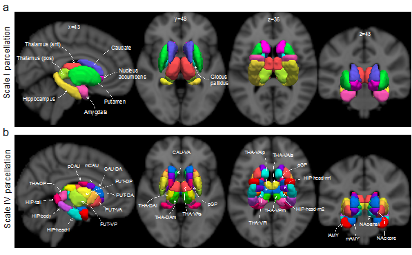 皮层|突破：墨尔本大学田野等绘制迄今为止最精细的人脑亚皮层功能图谱