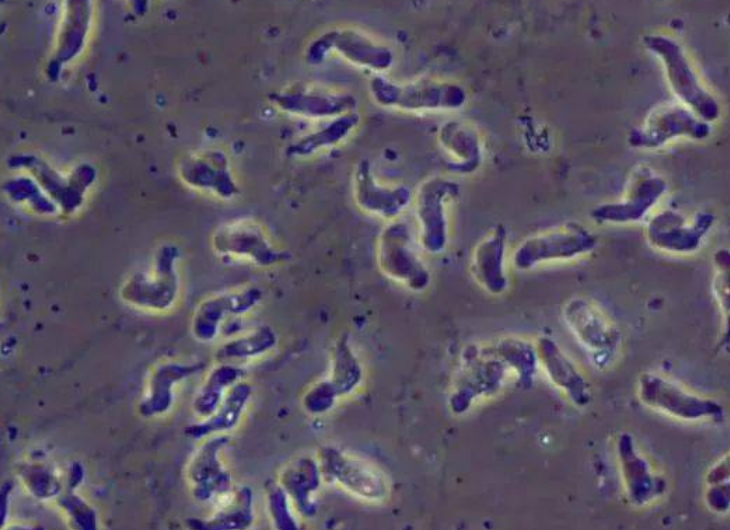 食脑虫|致死率高达97％！这次，美国人该怎么办？
