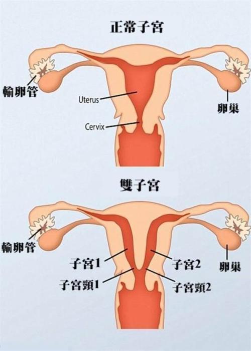 女性子宫位置示意图图片