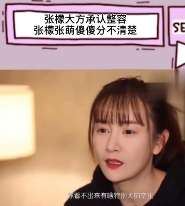 逗趣|女演员自曝做医美失败，拍戏脸肿成包子太逗趣，网友调侃撞脸杜华