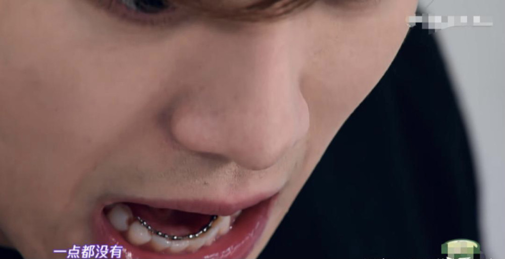 肖战坚持戴牙套两年,和四年前判若两人,颜值直线上升_腾讯新闻