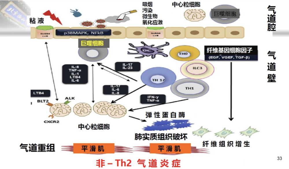 蔡柏蔷教授哮喘和慢阻肺重叠尚无明确诊断标准缺少临床药理研究该如何