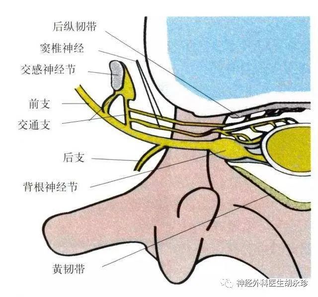 神經根型頸椎病根性痛