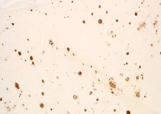 乙酰胆碱|脑科学日报：新一代乙酰胆碱探针实现体内乙酰胆碱信号的精确解析