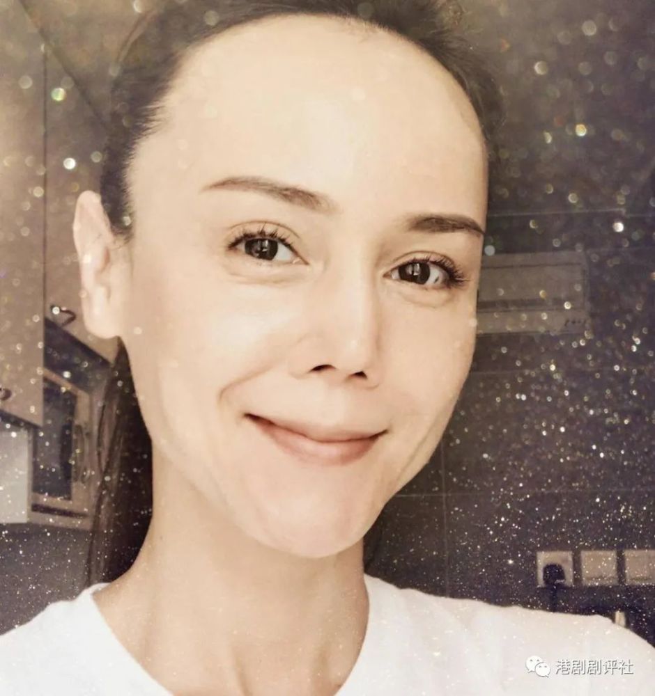 整容|祝福！前亚姐与前亚视小生由好友变情侣，曾样貌大变被网友误以为整容失败