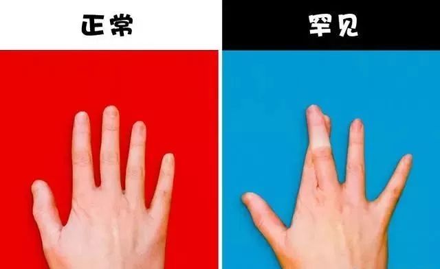 鼻子|9个大多数人的身体都无法做到的有趣事情