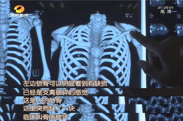 湖南省肿瘤医院|12岁男孩肺癌晚期！妈妈崩溃说出几个细节