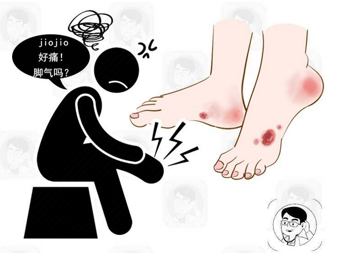 糖尿病并发症|脚总是莫名发痒，不一定和脚气有关！最怕的是被这种病所盯上