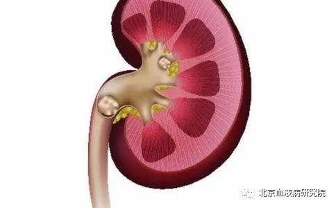 过敏性紫癜|血液病医学研究院北京中科血康：这件事对于过敏性紫癜的人很重要