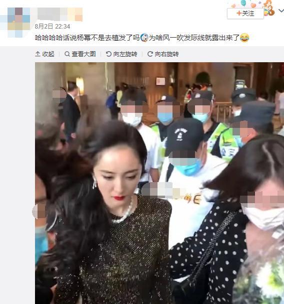 杨幂|杨幂晒针灸治疗照片，用碎发遮挡发际线？未见绯闻男友魏大勋关心