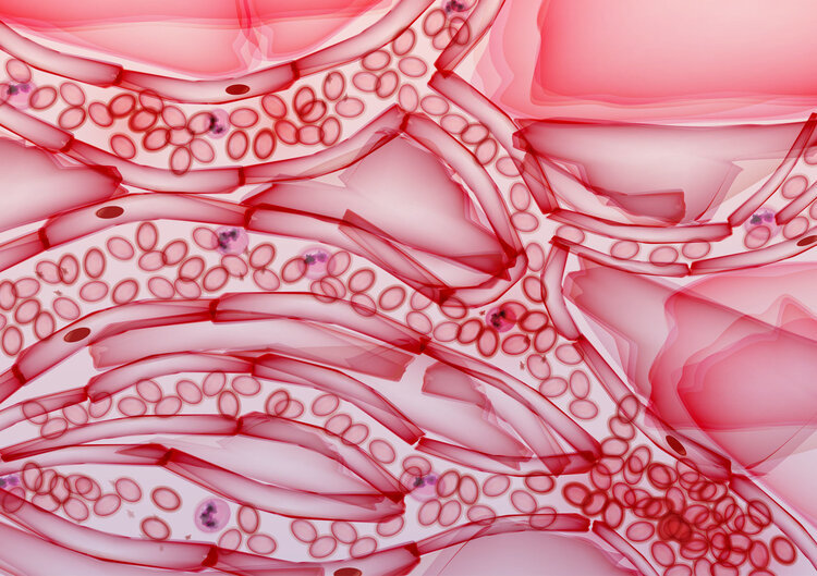 血栓|崴脚12天后不治身亡，一个健康人说没就没了？原因到底是什么？