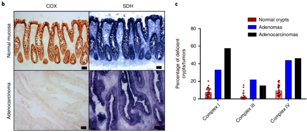 衰老|为何越老越容易患癌，衰老加速肠道肿瘤？
