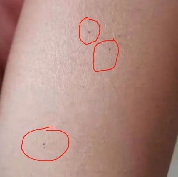 深挖牵出更多虐童前科