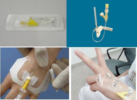 留置针您需要注意的那点事