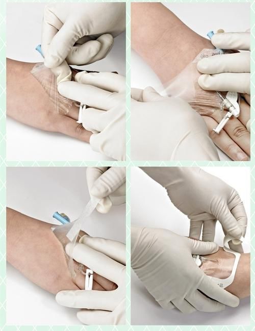 留置针您需要注意的那点事