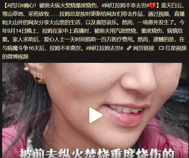 网红拉姆遭前夫纵火烧伤与病魔斗争16天仍不幸离世