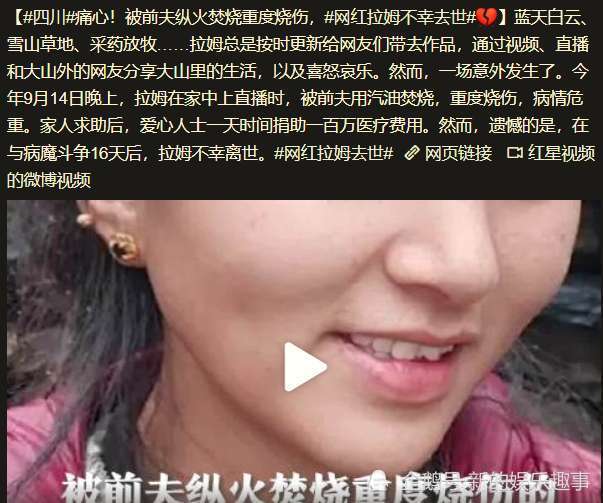 网红拉姆遭前夫纵火烧伤与病魔战斗16天后仍不幸离世