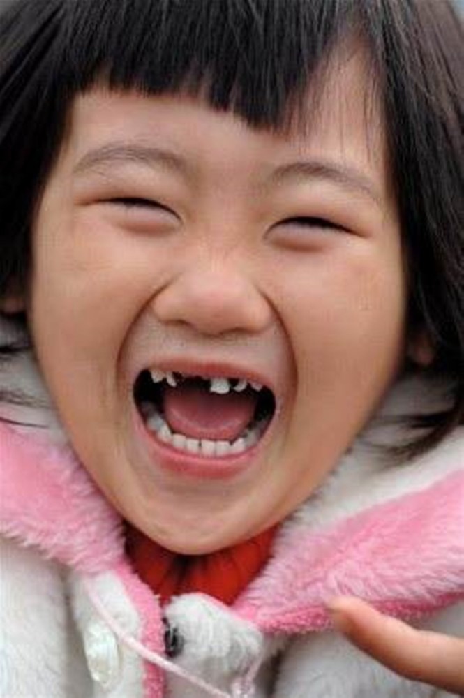 "6岁换牙就好了",3岁宝宝满口黑牙,妈妈却毫不在乎,医生怒斥