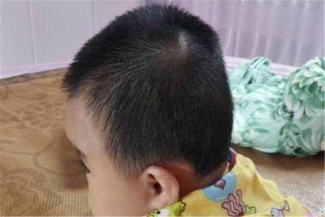妈妈,为什么我是扁头?孩子的一番话太扎心了,妈妈伤心受埋怨