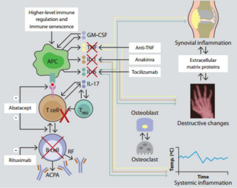 类风湿关节炎诊治的思考:重视鉴别及评估,给予最佳治疗_腾讯新闻
