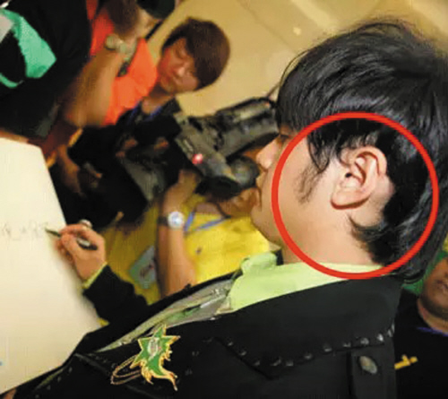 周杰伦遗传性脱发20多岁出席活动靠假发片私下戴帽子或头巾