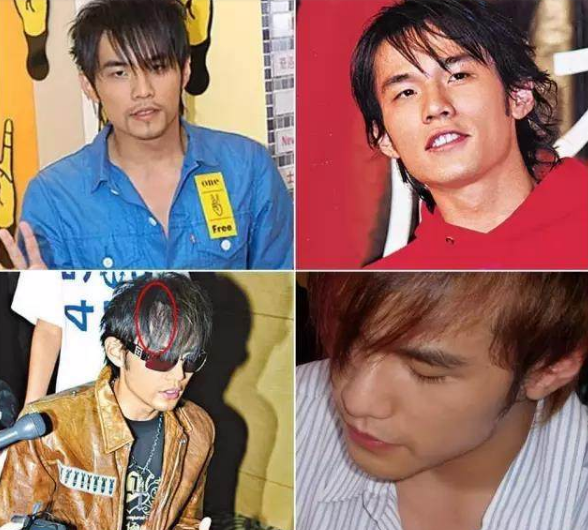 周杰伦遗传性脱发20多岁出席活动靠假发片私下戴帽子或头巾