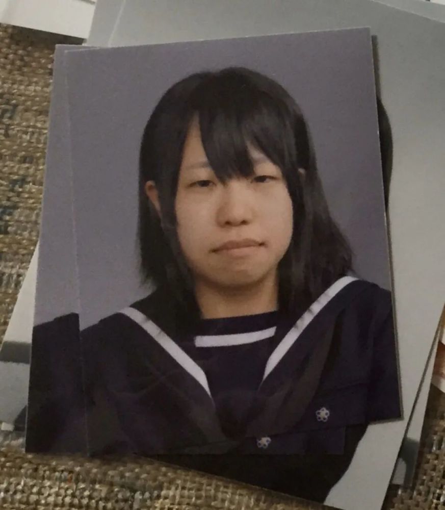 mikishi|日本妹纸因长相被霸凌怒而整形！是换头术没错了……