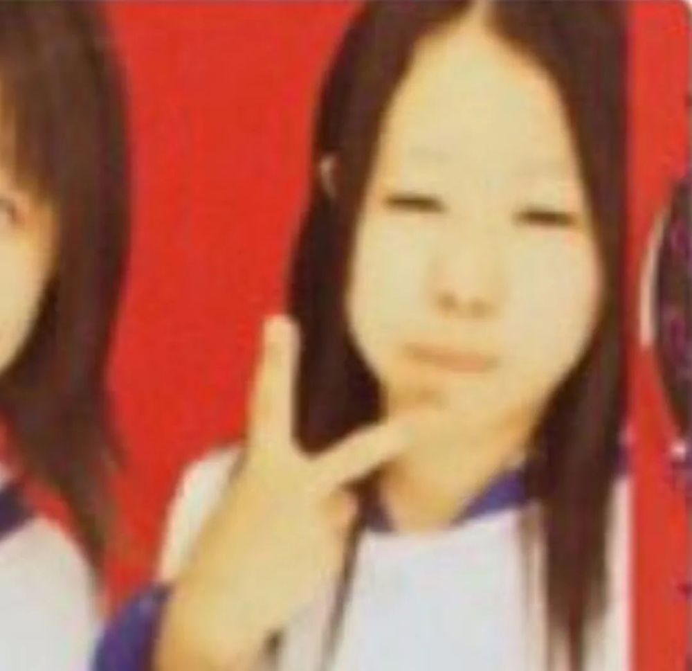 mikishi|日本妹纸因长相被霸凌怒而整形！是换头术没错了……