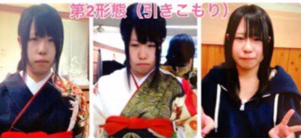mikishi|日本妹纸因长相被霸凌怒而整形！是换头术没错了……