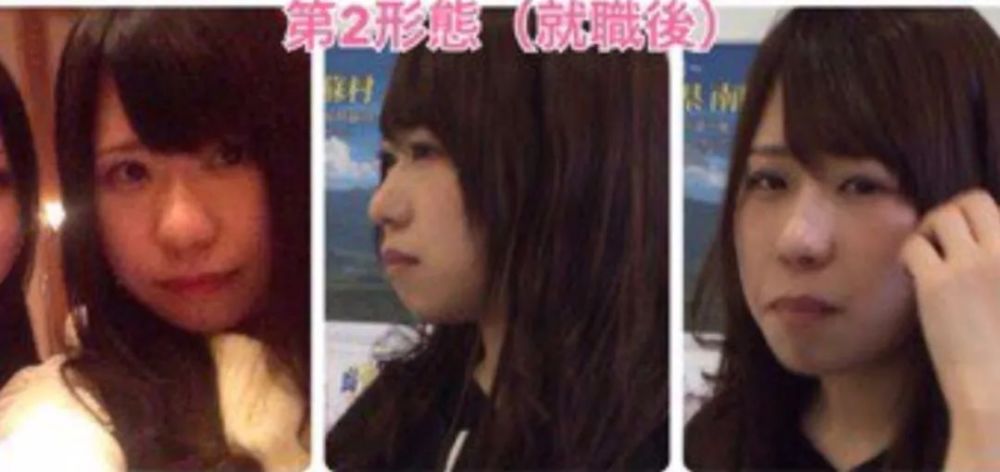 mikishi|日本妹纸因长相被霸凌怒而整形！是换头术没错了……