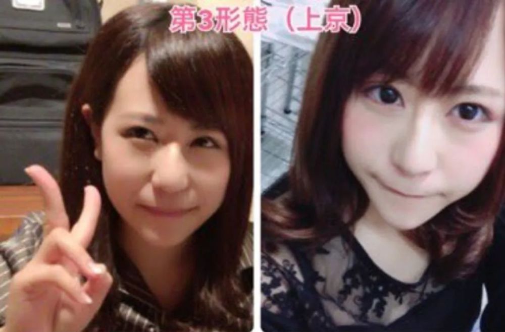 mikishi|日本妹纸因长相被霸凌怒而整形！是换头术没错了……