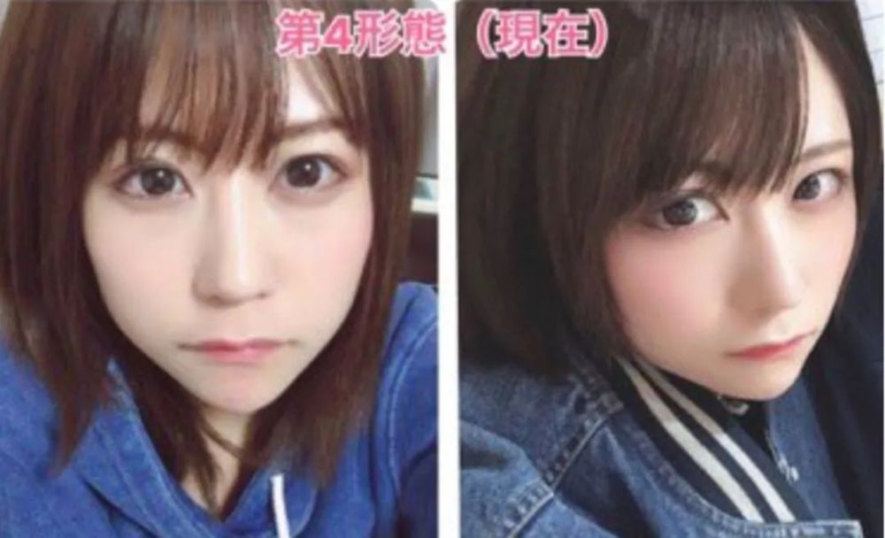 mikishi|日本妹纸因长相被霸凌怒而整形！是换头术没错了……