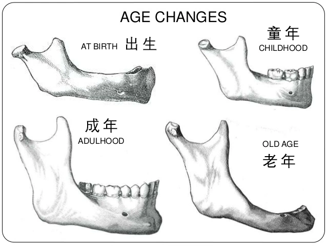 人的下颌骨发育差不多从10岁开始进入生长加速期,11