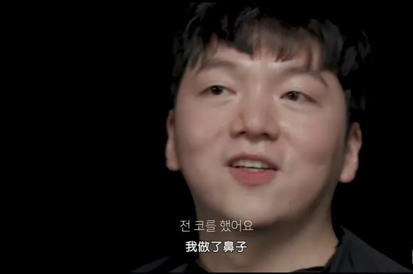 整容|一夜爆红却被扒出全身造假？这是整容极限了吧……