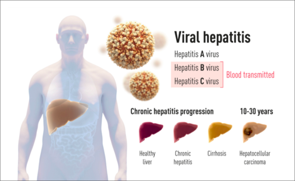 病毒|2020 诺奖成果解读：丙肝病毒是怎么被发现的？