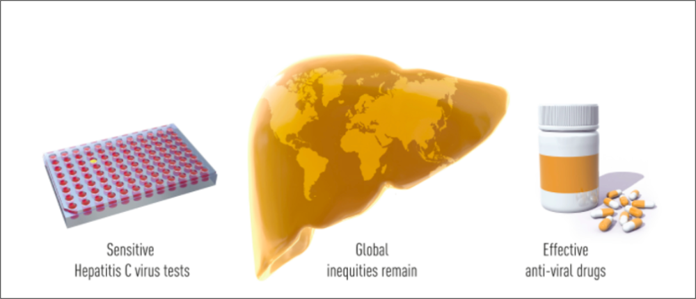 病毒|2020 诺奖成果解读：丙肝病毒是怎么被发现的？