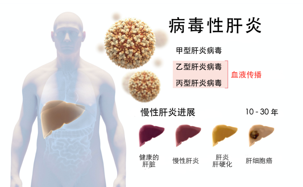 丙型肝炎病毒|诺奖解析 抗击丙型肝炎