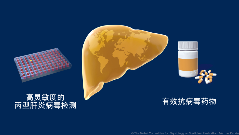 丙型肝炎病毒|诺奖解析 抗击丙型肝炎