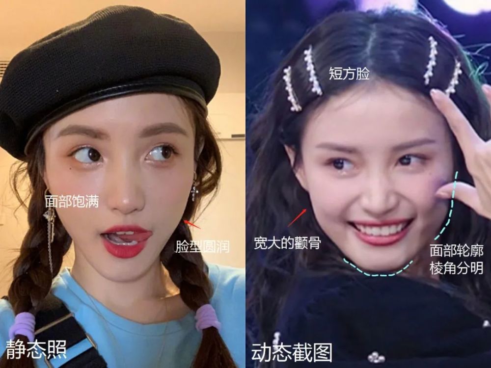 王思聪|王思聪最美前女友，咋成了馒头脸？