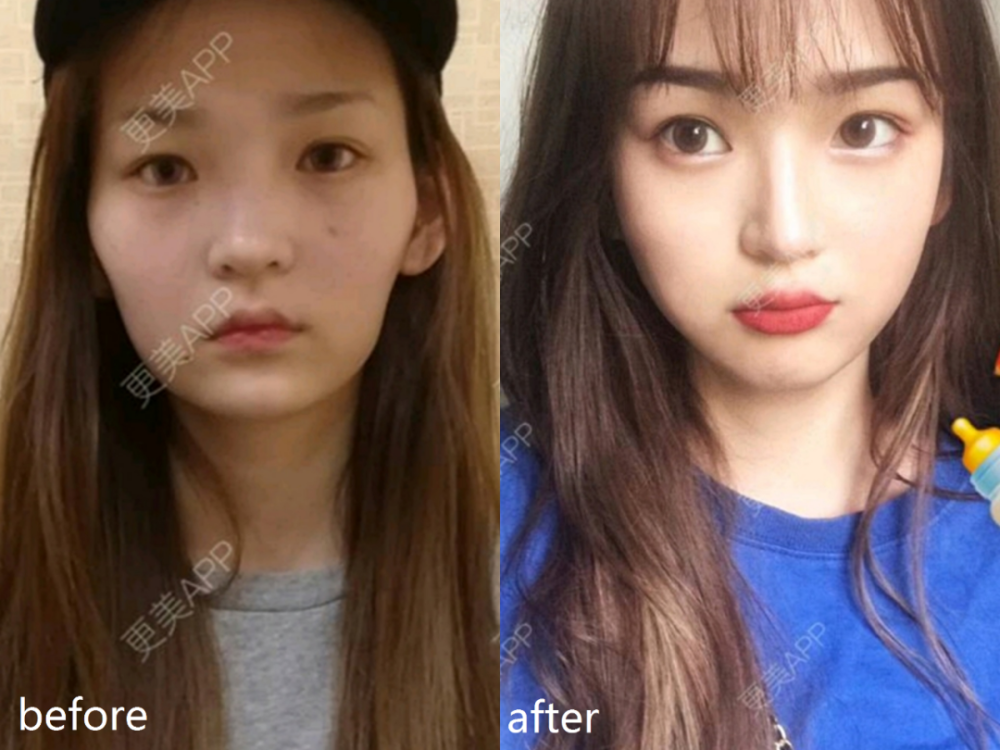 王思聪|王思聪最美前女友，咋成了馒头脸？