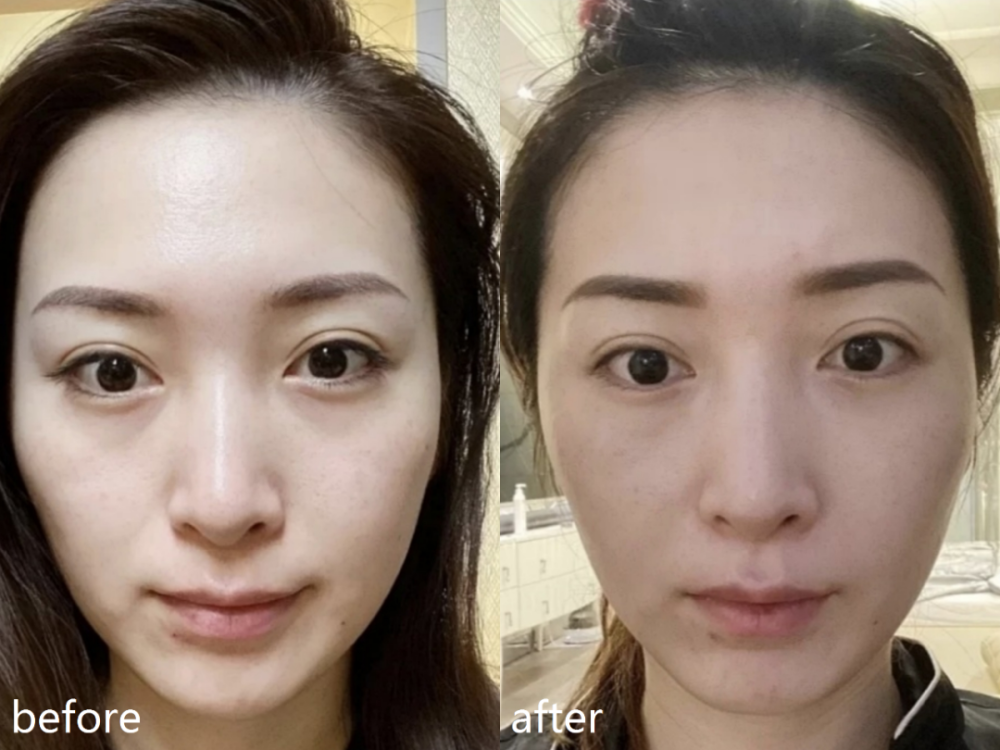 王思聪|王思聪最美前女友，咋成了馒头脸？