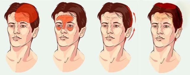 从头部经络的循行来区分头痛的类型针灸取穴依据及特效引经草药