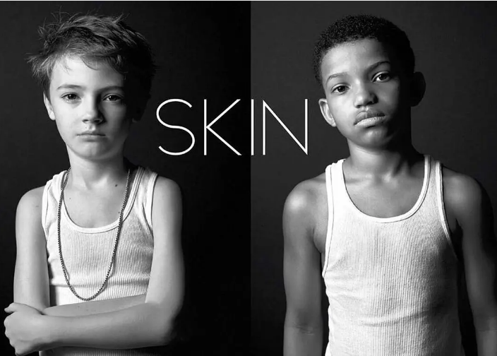 皮肤颜色并不决定好坏,微电影《肤色》