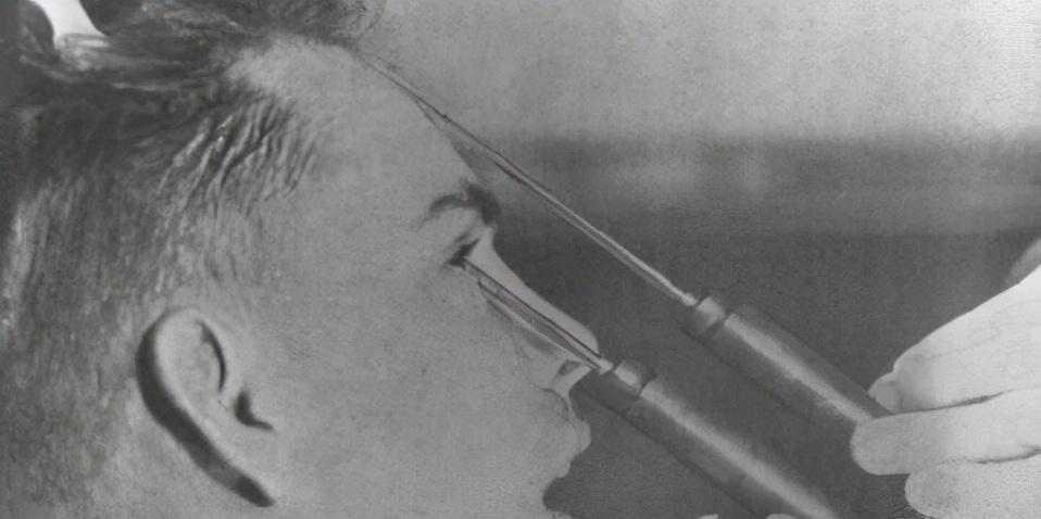 诺贝尔|这位医生发明这项手术，获得诺贝尔生物学或医学奖，也毁了上万人